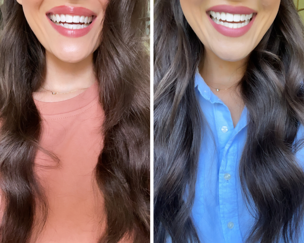 My Smile Journey - Musings by Madison, Beauty and Style Blogger